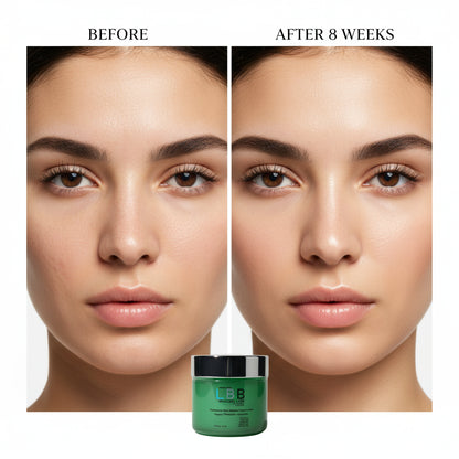 Before and after comparison of a woman's face with a green skincare product jar labeled 'LBB'.